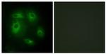 DLEC1 Antibody in Immunocytochemistry (ICC/IF)