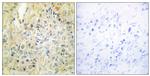 DLEC1 Antibody in Immunohistochemistry (Paraffin) (IHC (P))