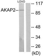 AKAP2 Antibody in Western Blot (WB)