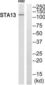 STARD13 Antibody in Western Blot (WB)
