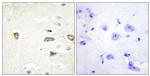 MRCK beta Antibody in Immunohistochemistry (Paraffin) (IHC (P))
