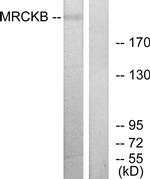 MRCK beta Antibody in Western Blot (WB)