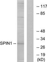 SPIN1 Antibody in Western Blot (WB)