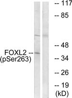 Phospho-FOXL2 (Ser263) Antibody in Western Blot (WB)