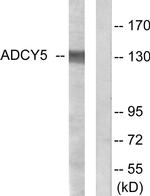 Adenylate Cyclase 5 Antibody in Western Blot (WB)