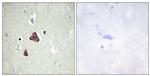 Adenylate Cyclase 8 Antibody in Immunohistochemistry (Paraffin) (IHC (P))