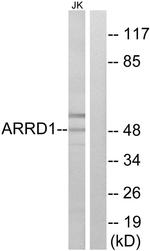 ARRDC1 Antibody in Western Blot (WB)