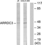 ARRDC3 Antibody in Western Blot (WB)
