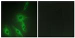 RALGAPA2 Antibody in Immunocytochemistry (ICC/IF)