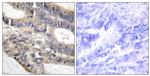 RALGAPA2 Antibody in Immunohistochemistry (Paraffin) (IHC (P))