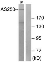 RALGAPA2 Antibody in Western Blot (WB)