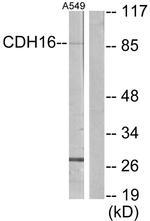 CDH16 Antibody in Western Blot (WB)