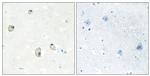 CDH22 Antibody in Immunohistochemistry (Paraffin) (IHC (P))