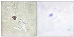 CDH9 Antibody in Immunohistochemistry (Paraffin) (IHC (P))