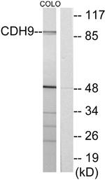 CDH9 Antibody in Western Blot (WB)
