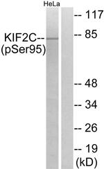 Phospho-MCAK (Ser95) Antibody in Western Blot (WB)