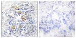 CD83 Antibody in Immunohistochemistry (Paraffin) (IHC (P))