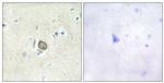 CELSR3 Antibody in Immunohistochemistry (Paraffin) (IHC (P))