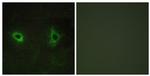 COL4A3 Antibody in Immunocytochemistry (ICC/IF)