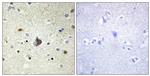 COL4A3 Antibody in Immunohistochemistry (Paraffin) (IHC (P))