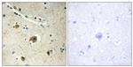 COL4A4 Antibody in Immunohistochemistry (Paraffin) (IHC (P))
