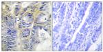 COL4A5 Antibody in Immunohistochemistry (Paraffin) (IHC (P))