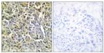 COL6A2 Antibody in Immunohistochemistry (Paraffin) (IHC (P))