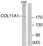 COL11A1 Antibody in Western Blot (WB)