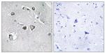 COL11A2 Antibody in Immunohistochemistry (Paraffin) (IHC (P))