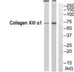 COL13A1 Antibody in Western Blot (WB)