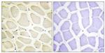 COL20A1 Antibody in Immunohistochemistry (Paraffin) (IHC (P))