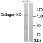 COL20A1 Antibody in Western Blot (WB)