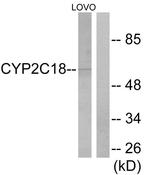 Cytochrome P450 Pan Antibody in Western Blot (WB)