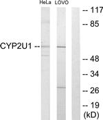 CYP2U1 Antibody in Western Blot (WB)