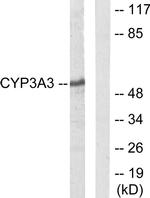CYP3A4/CYP3A5 Antibody in Western Blot (WB)