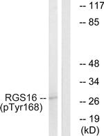 Phospho-RGS16 (Tyr168) Antibody in Western Blot (WB)