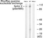 Phospho-GEF-H1 (Ser885) Antibody in Western Blot (WB)