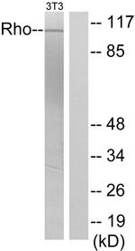 GEF-H1 Antibody in Western Blot (WB)