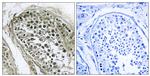 GAB4 Antibody in Immunohistochemistry (Paraffin) (IHC (P))