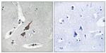 GRID1 Antibody in Immunohistochemistry (Paraffin) (IHC (P))