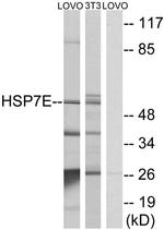 HSPA14 Antibody in Western Blot (WB)