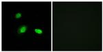 HSPB2 Antibody in Immunocytochemistry (ICC/IF)