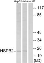 HSPB2 Antibody in Western Blot (WB)
