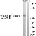 Phospho-VDR (Ser208) Antibody in Western Blot (WB)