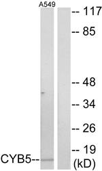 Cytochrome B5 Antibody in Western Blot (WB)