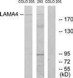 Laminin alpha-4 Antibody in Western Blot (WB)