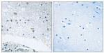 Laminin gamma-3 Antibody in Immunohistochemistry (Paraffin) (IHC (P))