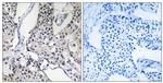 PHLDA3 Antibody in Immunohistochemistry (Paraffin) (IHC (P))