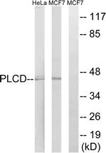 AGPAT4 Antibody in Western Blot (WB)