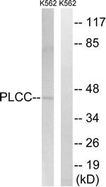 AGPAT3 Antibody in Western Blot (WB)